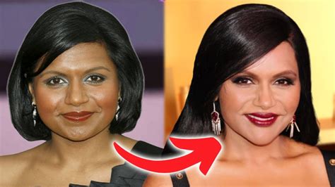 Mindy Kaling Plastic Surgery: Transformation Photos,。